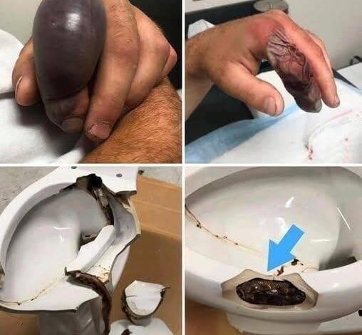 He Sat Down Like Any Other Day Then Something From The Toilet Changed His Life Forever