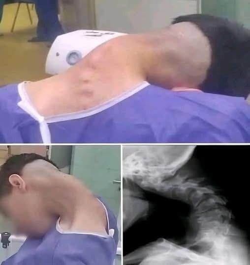 HIS HEAD SUDDENLY DROPPED AND HE COULD NOT LIFT IT BACK UP THE TERRIFYING TRUTH ABOUT THE SMARTPHONE SYNDROME RUINING YOUNG LIVES