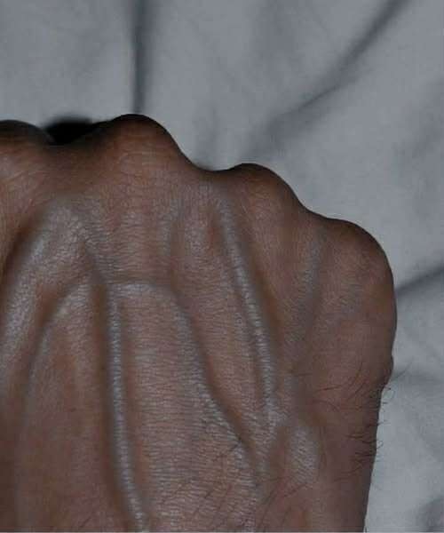 Why Your Veins Appear More Prominent