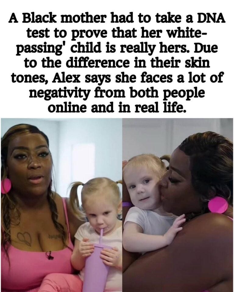 A Black mother had to take a DNA test to prove that her white- passing’ child is really hers.Due to the difference in their skin tones, Alex says she faces a lot of neg… See more