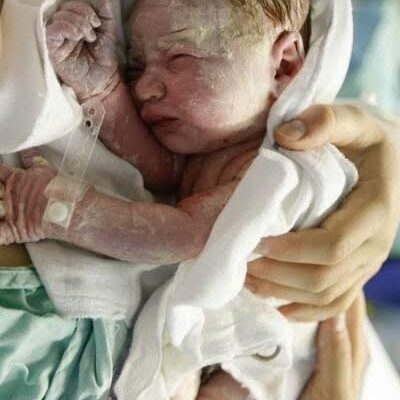 😱😱Baby born with an DIU peg… See more