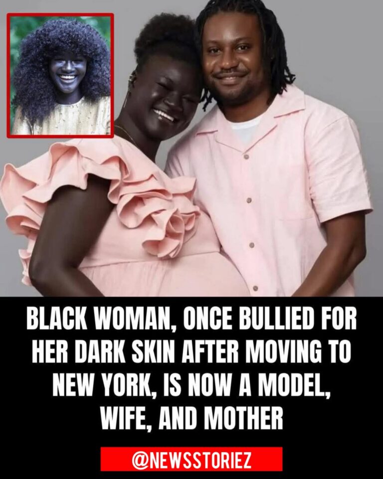 From Mocked to Magnificent: How Khoudia Diop Turned Her Dark Skin Into a Global Symbol of Beauty