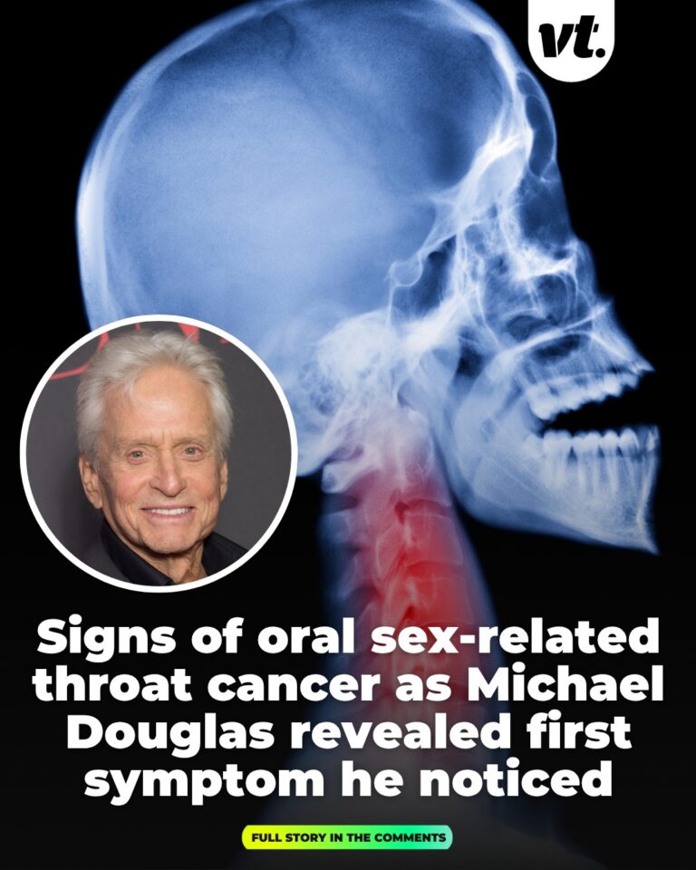 Signs of oral sex-related throat cancer as Michael Douglas revealed first symptom he noticed