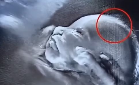 Doctors Mortified After Ultrasound Reveals Something Impossible Growing Inside Mother