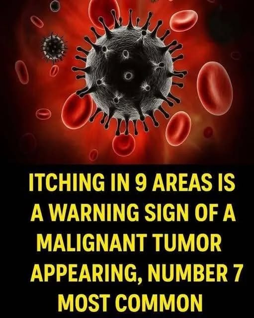 Itching in 9 Areas: A Warning Sign of Malig