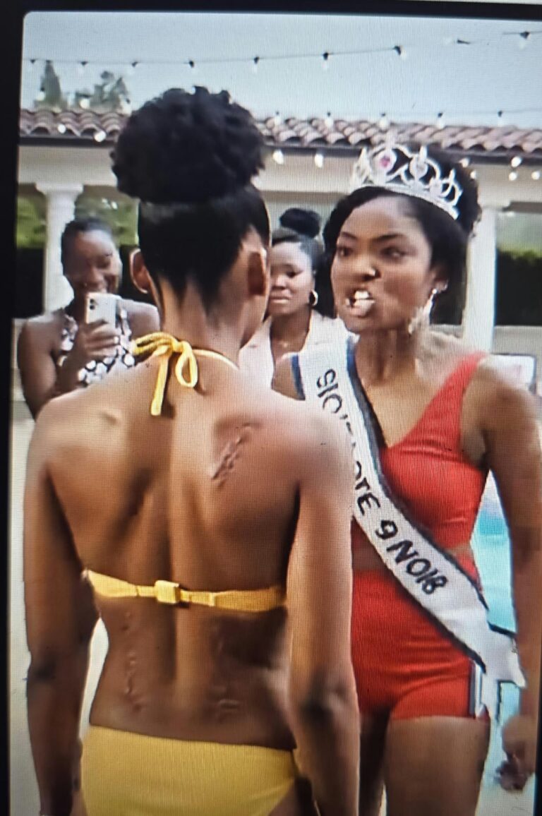 She Was Forced to Show Her Scars at Her Birthday Party—Then She Took the Microphone